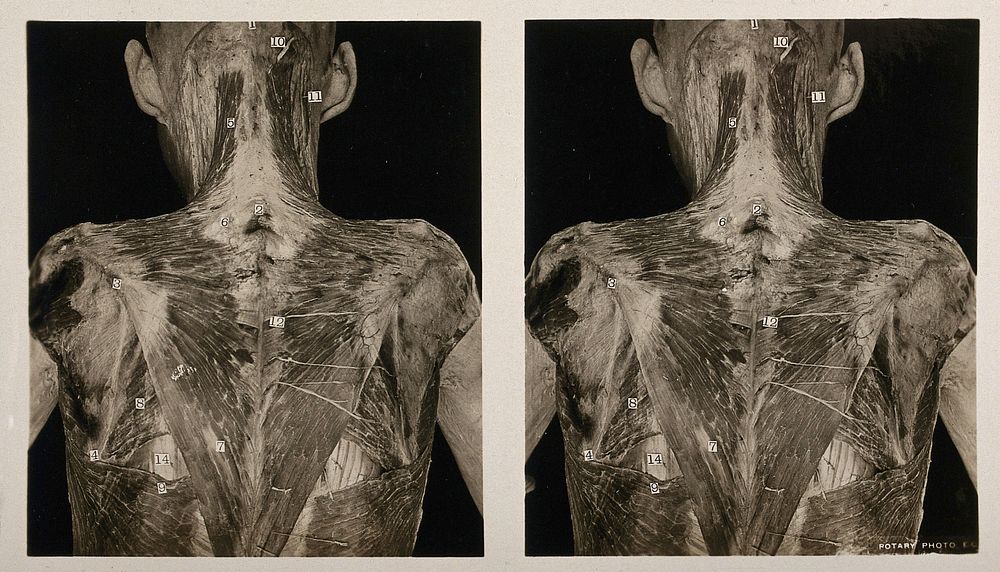 Anatomy: écorché human back, showing | Free Photo - rawpixel