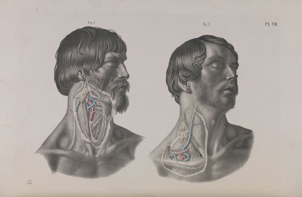 Plate VII, Arteries, veins and muscles of the neck.
