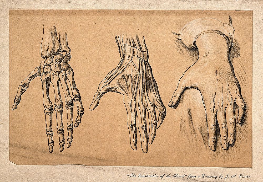 The hand: three figures, (left to right) bones, muscles, and surface anatomy. Colour lithograph, 1868, after J.A. Vinter.