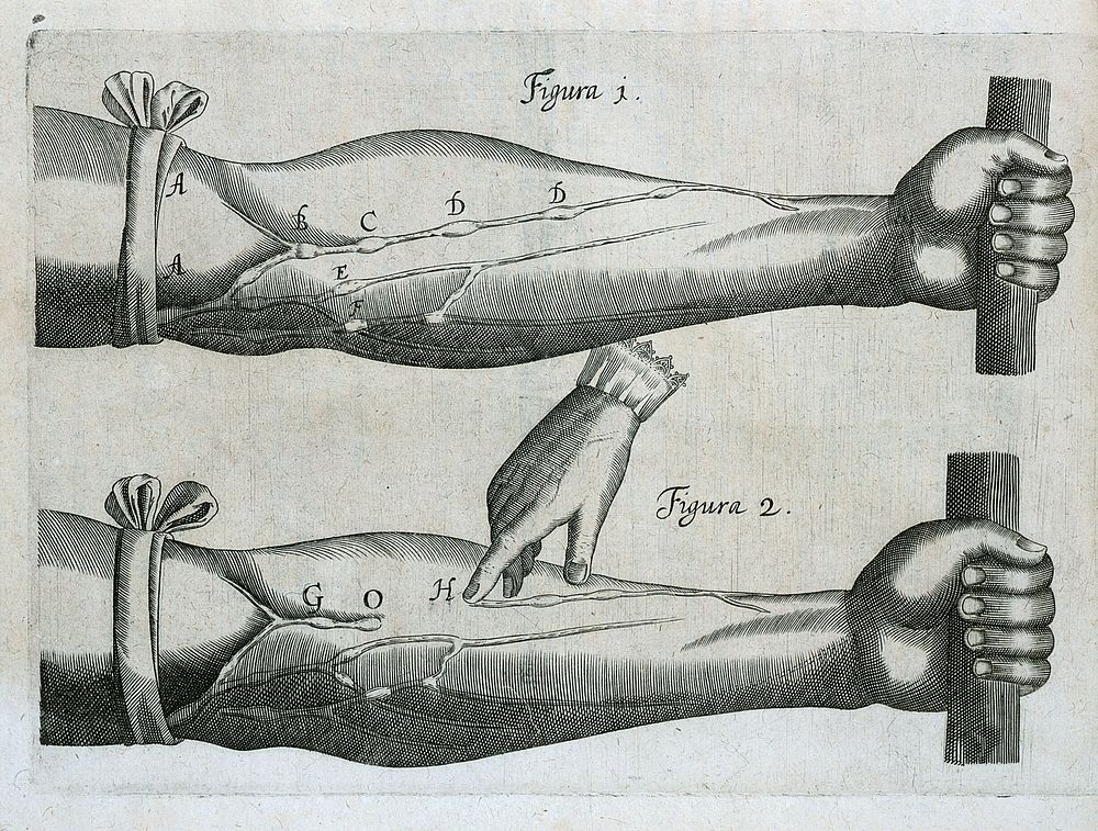 Exercitatio anatomica de motu cordis et sanguinis in animalibus / Guilielmi Harvei.