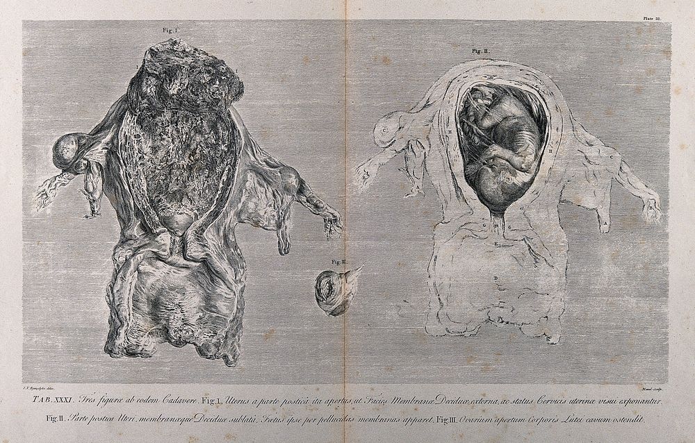 Dissections of the pregnant uterus and the corpus luteum in the left overy, at five months: three figures. Copperplate…