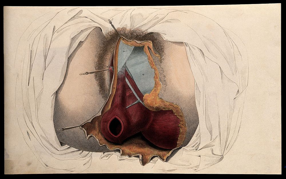 The female reproductive system: dissection of the genitalia and anus. Coloured line engraving by W.H. Lizars, ca. 1827.