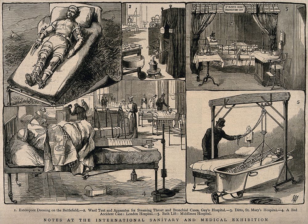 Five kinds of treatment in hospitals and elsewhere. Wood engraving, 1881.