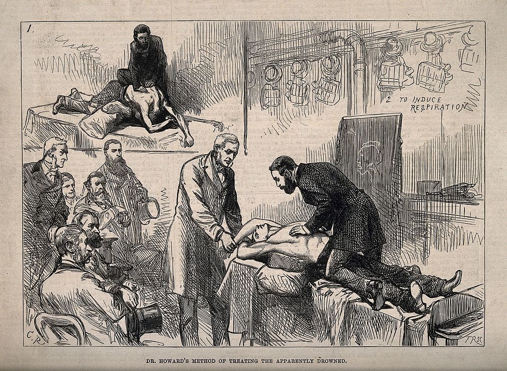 Benjamin Howard assisted by Sir E. Sieveking demonstrating artificial respiration on a supine figure at the Royal Humane…