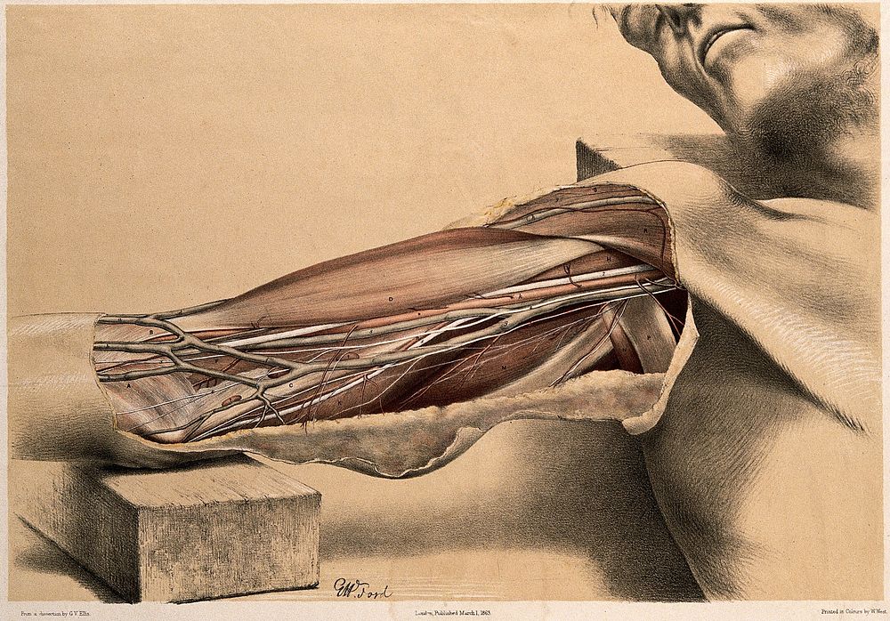 Dissection showing the muscles, blood vessels and nerves of the upper arm. Colour lithograph by G.H. Ford, 1863.