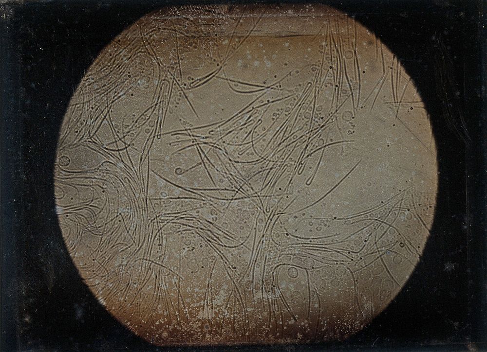 Spermatozoa of a frog. Photomicrograph by Léon Foucault, 1844.