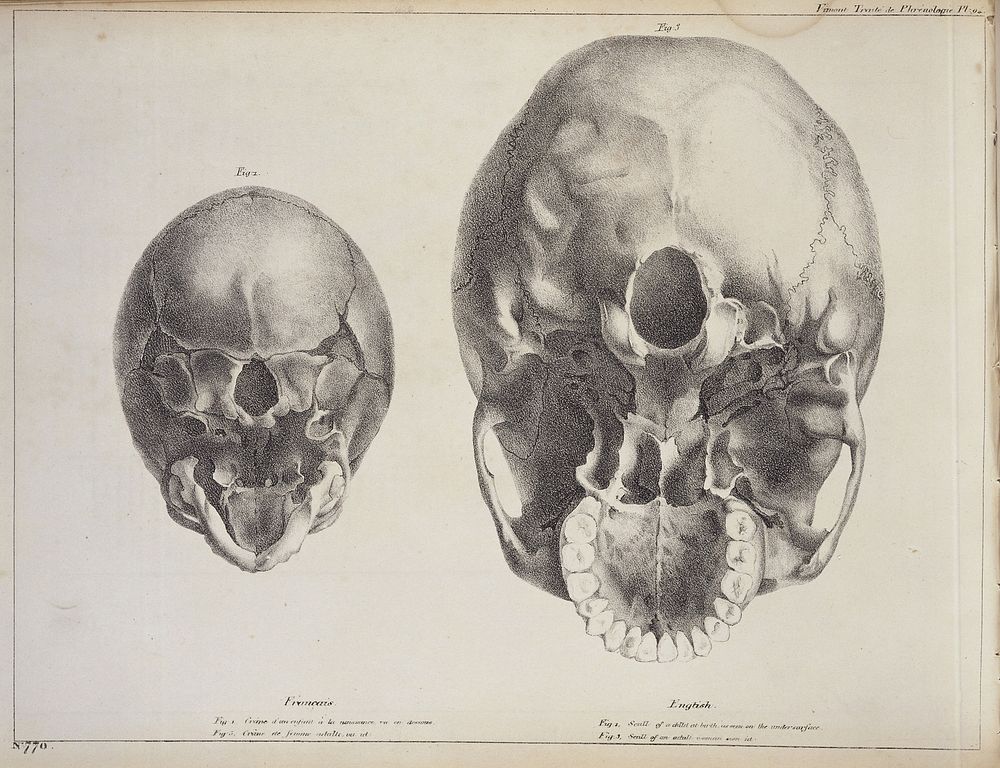 Skull of child at birth and woman