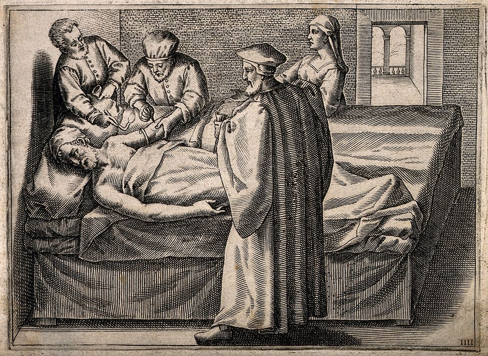 A surgeon about to bleed a man's arm, he is aided by an older surgeon and an assistant, a woman (the patient's wife ) is…