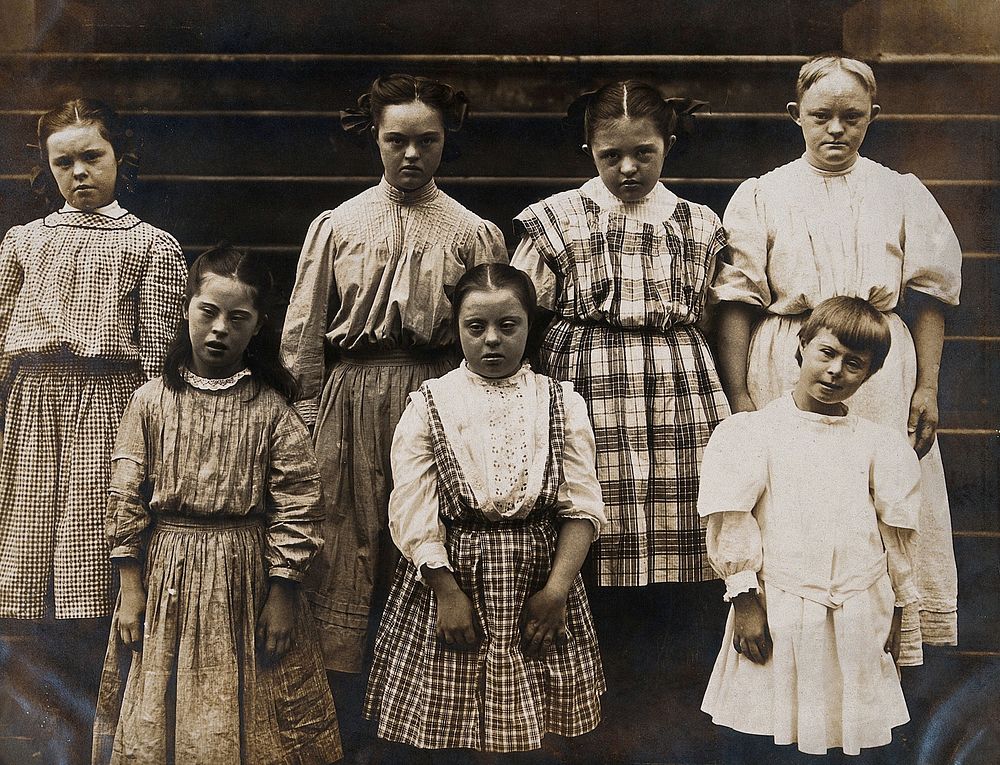 New York State Institute: a group of girls with Down's syndrome, standing on some steps. Photograph.