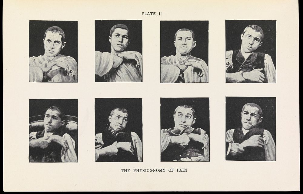 The Physiognomy of Pain, Plate II, Fear by A. Mosso