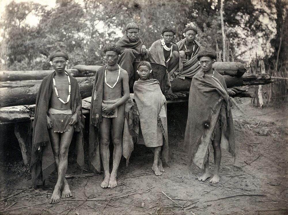 Nagaland, India: Ao Nagas tribespeople, one of whom is suffering from a goitre. Photograph, 1900/1910.