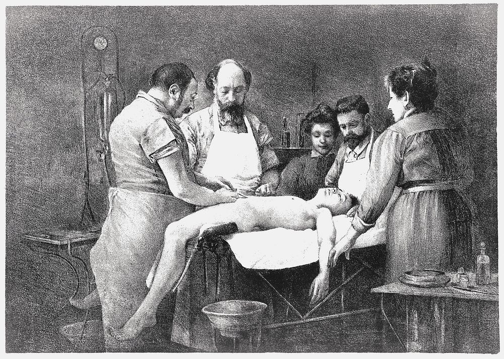 A surgeon performing a suprapubic lithotomy on a boy. Lithograph by R. Lemoine, 1899.