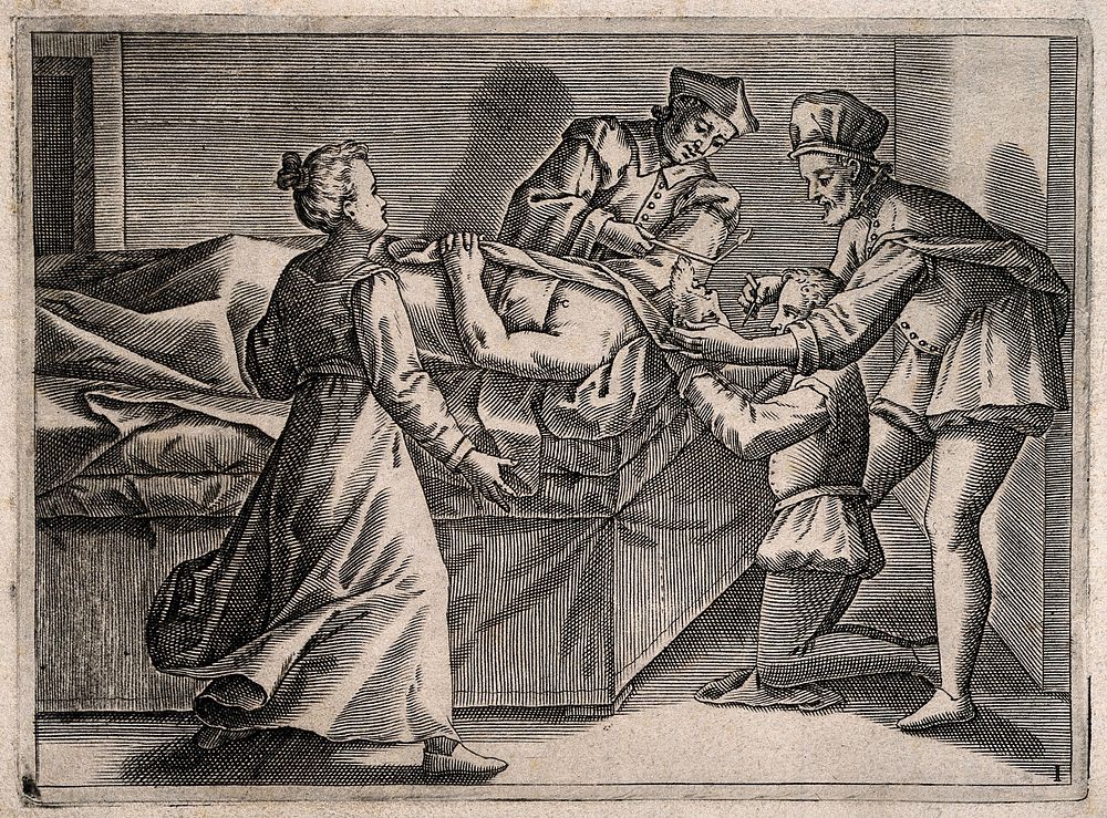 A surgeon bleeding a man's head, he is aided by two assistants, a woman (the patient's wife ) appears anxious. Engraving…