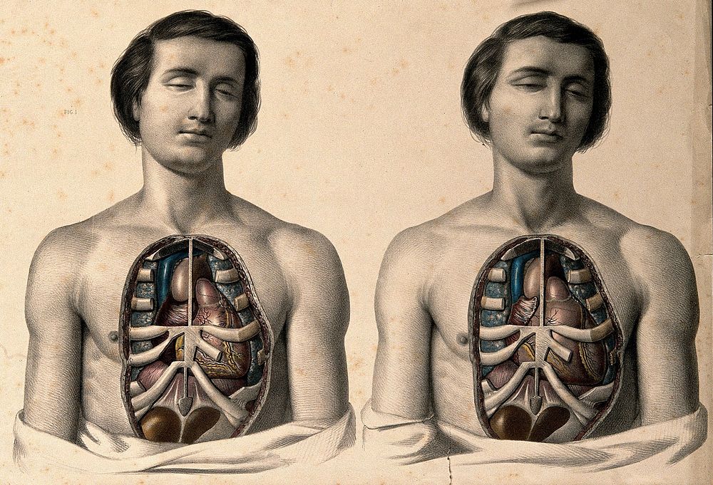 The body of a youth with his trunk dissected: two figures showing the ribs and viscera, especially the position of the heart…