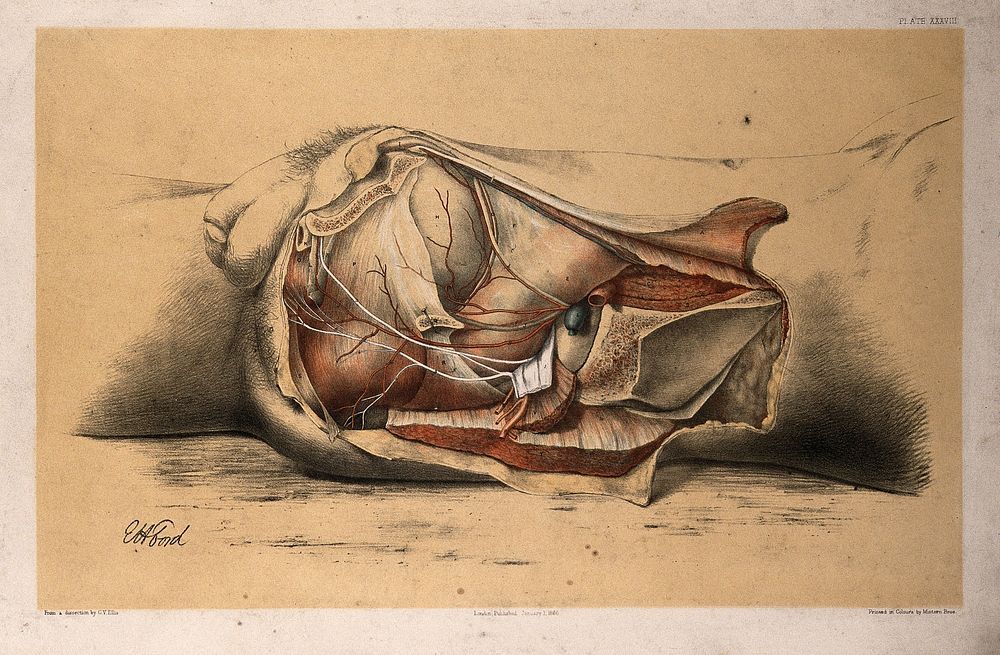 Dissection of the pelvis and abdomen of a man, showing the arteries, blood vessels and muscles: side view. Colour lithograph…