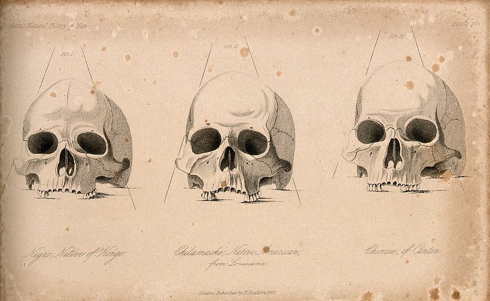 Human skulls: three figures showing the skulls of an African, a Native American and a Chinese. Stipple engraving, 1843.