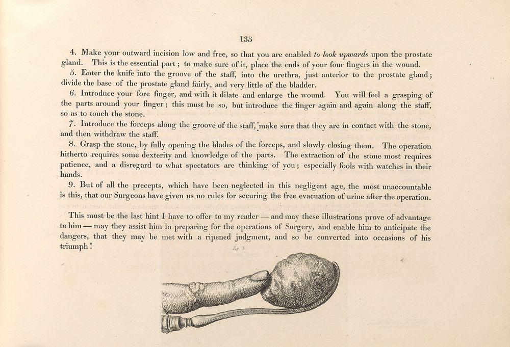 Illustrations of the great operations of surgery, trepan, hernia, amputation, aneurism, and lithotomy / By Charles Bell.