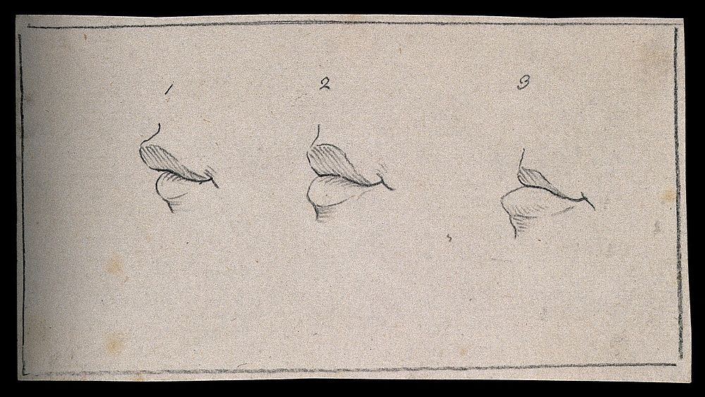 Three mouths with variously projecting lips. Drawing, c. 1793.