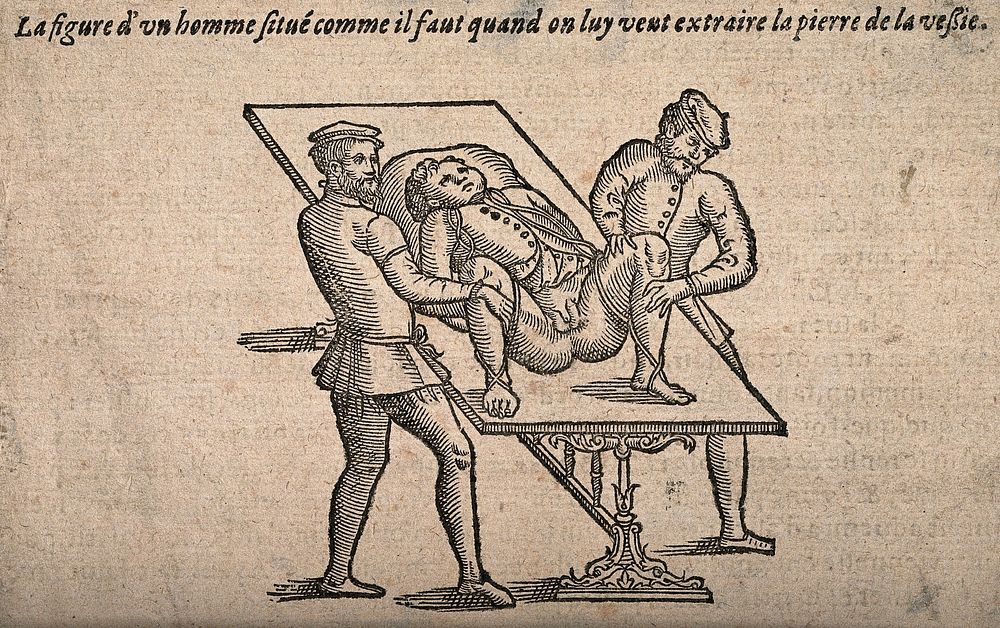 A male patient on a table being held in the lithotomy position by two assistants. Woodcut, 1628.
