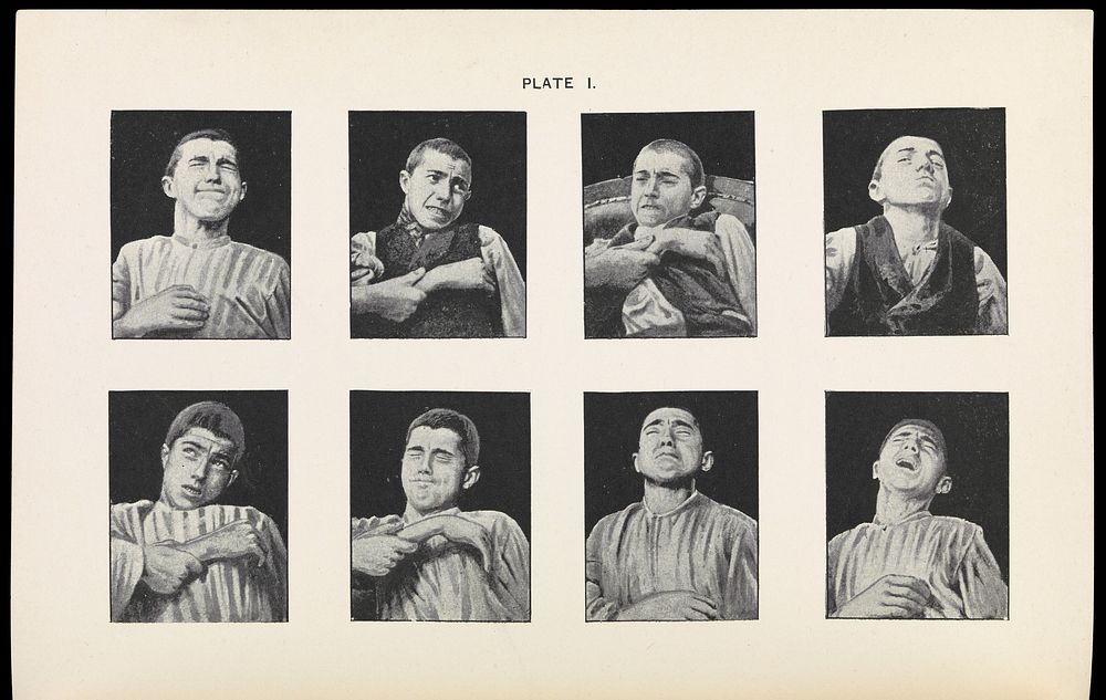 The Physiognomy of Pain, Plate I, Fear by A. Mosso