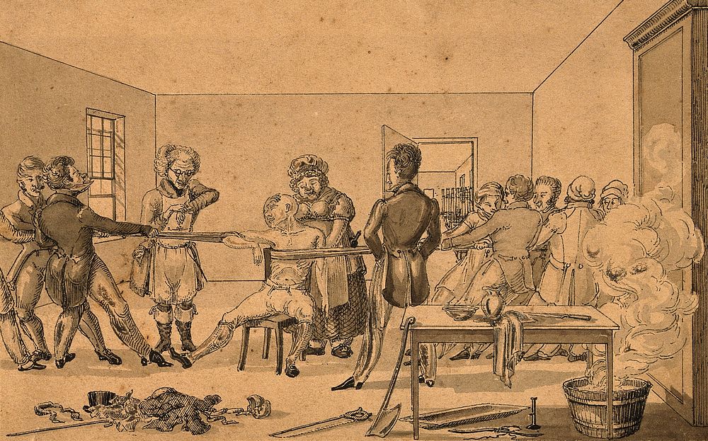 A surgeon supervising two groups of people pulling in opposite directions in order to cure a man with a shoulder…