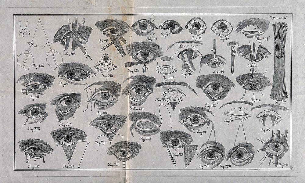 A sheet of eye examinations and diagrams of the eye with a numbered key. Wood engraving.