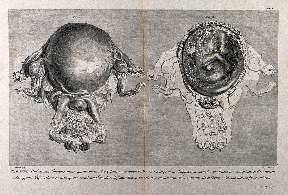 Dissections of the pregnant uterus at five months: two figures. Copperplate engraving by P.C. Canot after J.V. Rymsdyk…