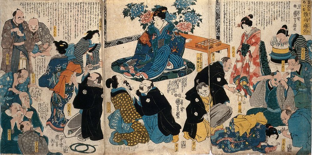 Medical and surgical treatments for a lame princess and others. Colour woodcut by Kuniyoshi, 1849/1852.