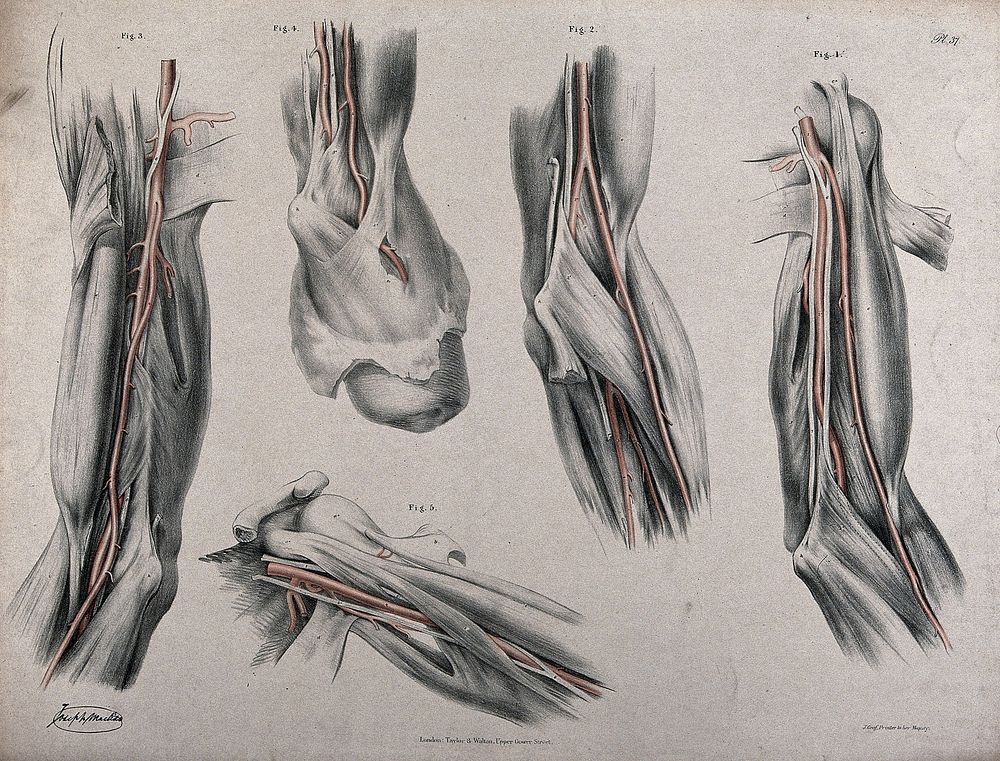 The circulatory system: dissections of the arm and shoulder, with arteries and blood vessels indicated in red. Coloured…