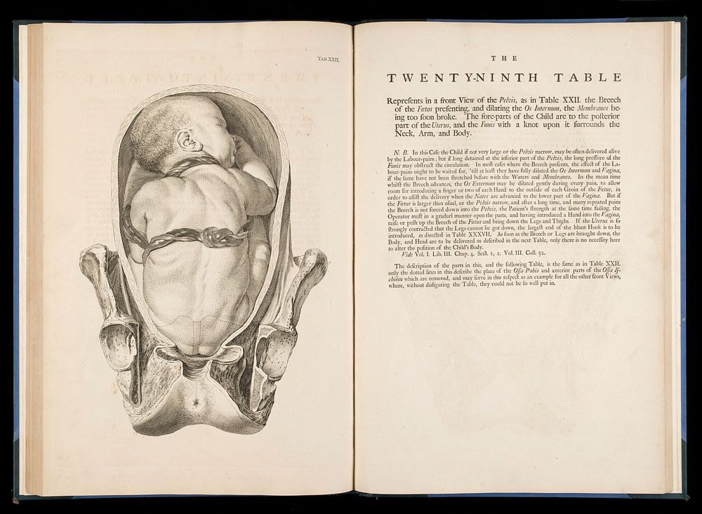 The twentyninth table from "A sett of anatomical tables.."