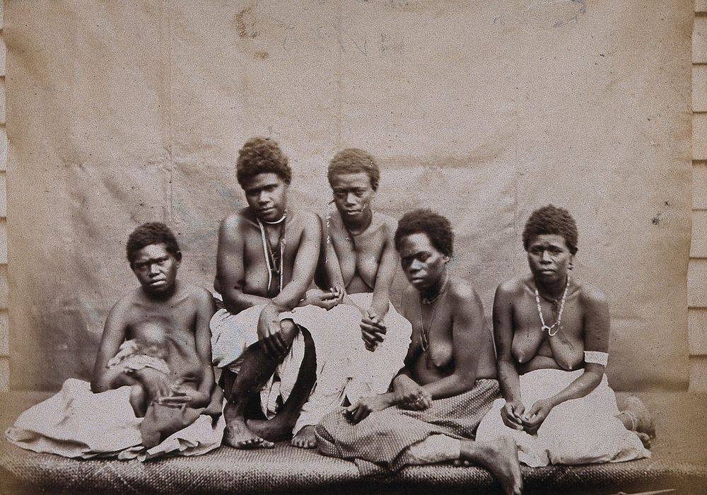Polynesia: Polynesian women with bare breasts, seated: group portrait. Photograph attributed to André-Alexandre Jollet.