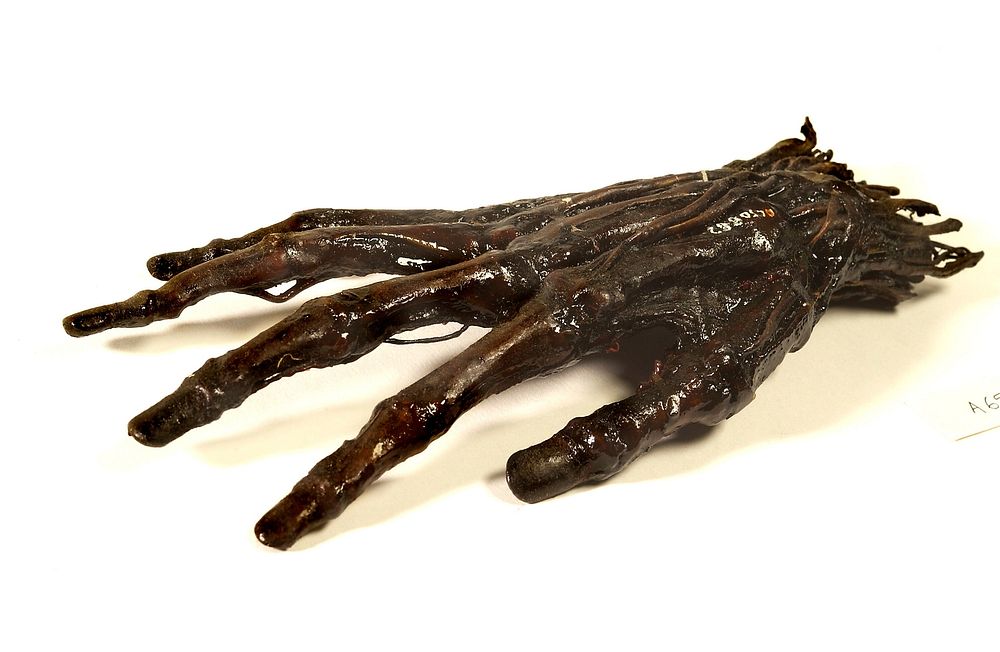 A human hand anatomised and preserved for teaching.