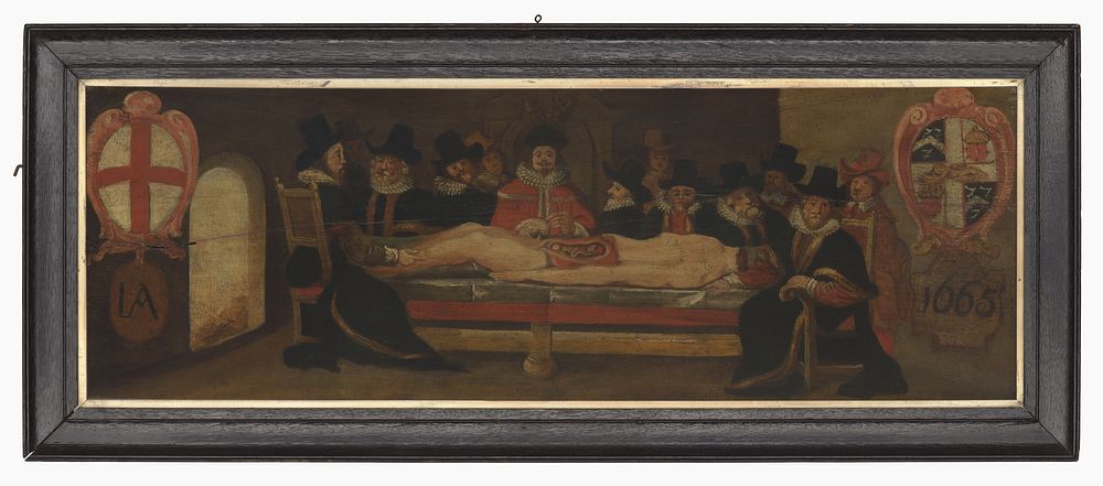 The dissection of a corpse before a company of surgeons . Oil painting.