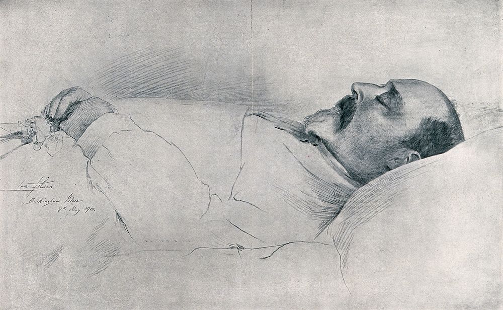 King Edward VII on his deathbed in Buckingham Palace in 1910. Line process print after a drawing by Sir Luke Fildes, 1910.