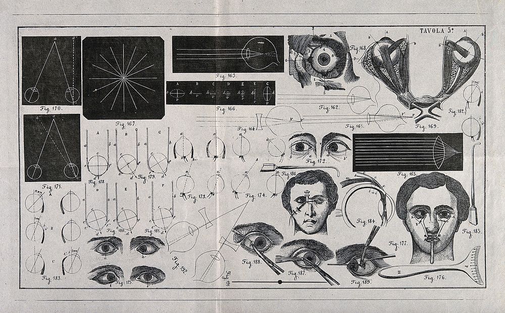 A sheet showing optical instruments, eye examinations, diagrams to show the effect of lenses and diagrams of the eye with a…