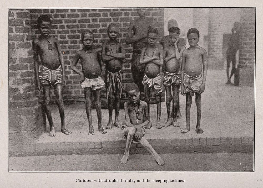 A group of children suffering from sleeping sickness. Reproduction of a photograph.