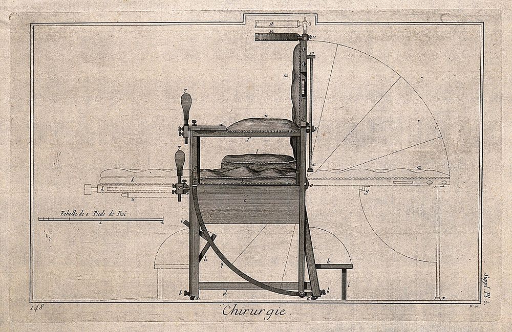 Surgical apparatus: a chair used for surgery. Engraving with etching.