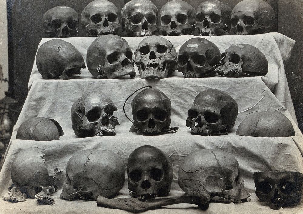 Skulls: twenty-one skulls or parts of skulls arranged in four rows. Photograph.