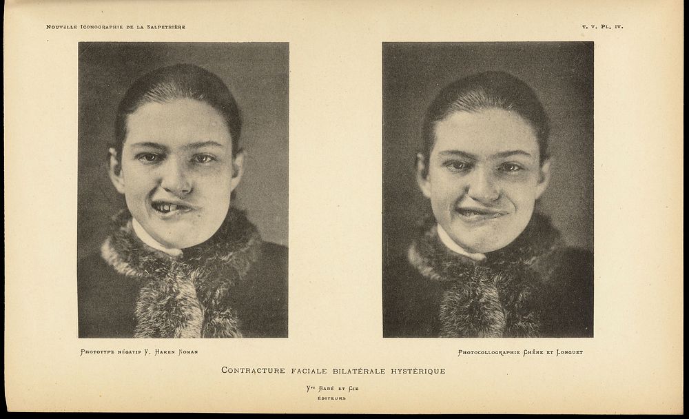 Two photographs showing different facial expressions.