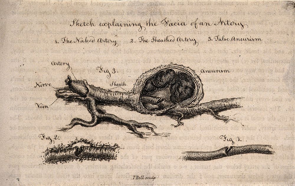 Three sections of a dissected artery, numbered for key. Etching by I. Bell, c. 1815 .