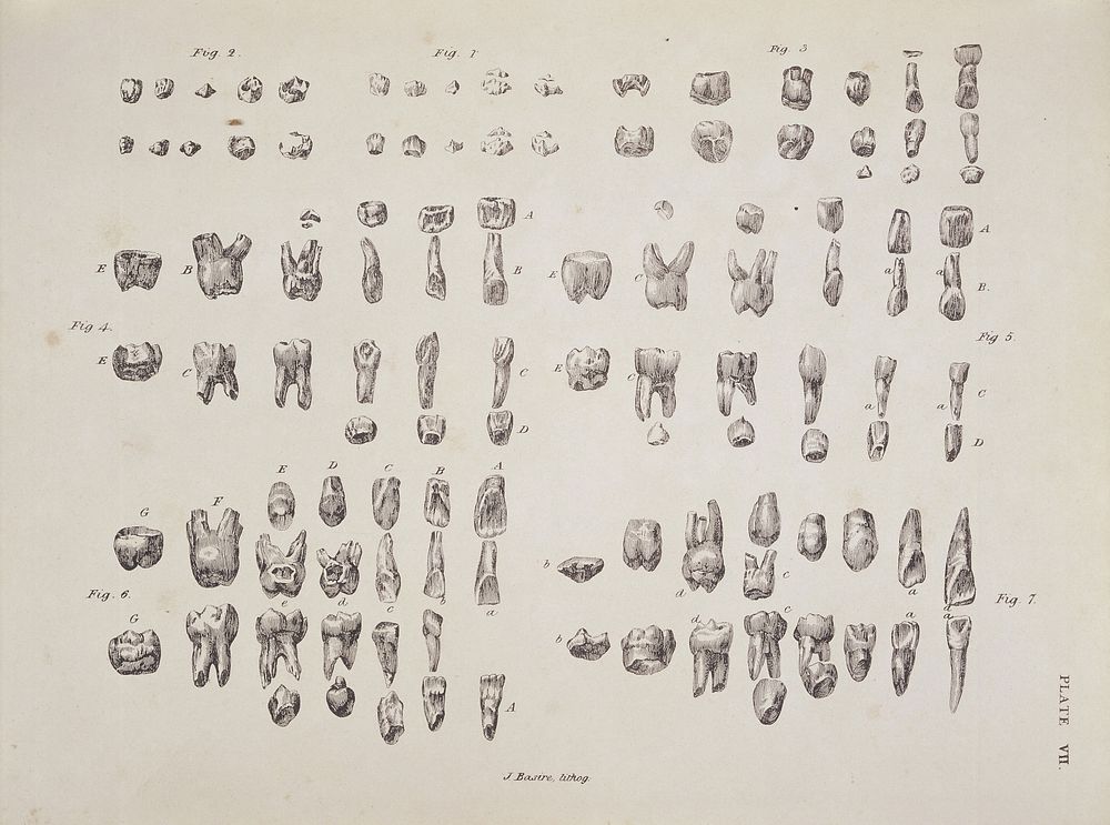 Plate VII. Human teeth.