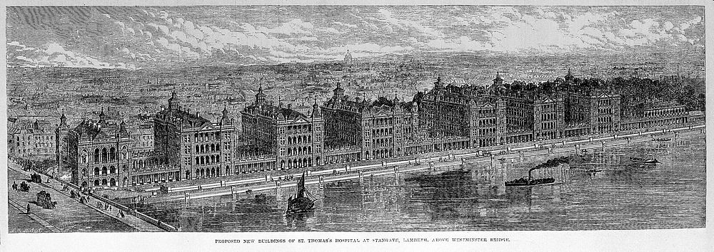 Proposed buildings for St. Thomas's Hospital, London, 1865