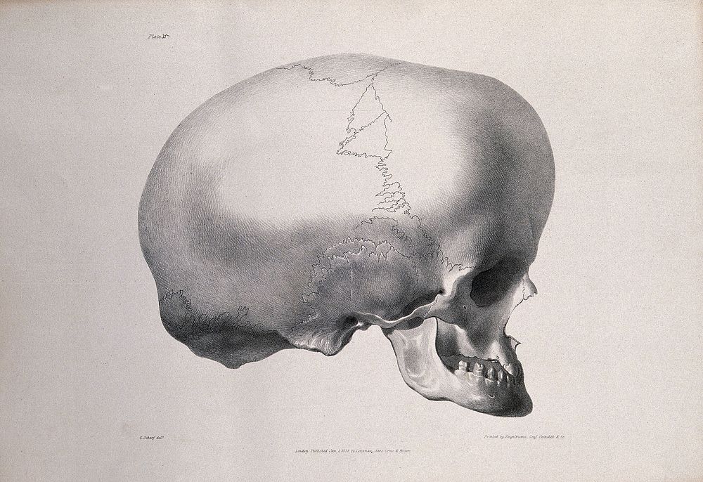 The deformed skull of James Cardinal: profile view. Lithograph after G. Scharf for Richard Bright, 1830.