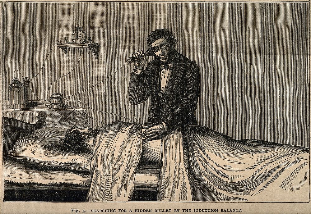 A surgeon using an electrical device to externally track a hidden bullet inside a patient's body. Wood engraving, ca. 1890.