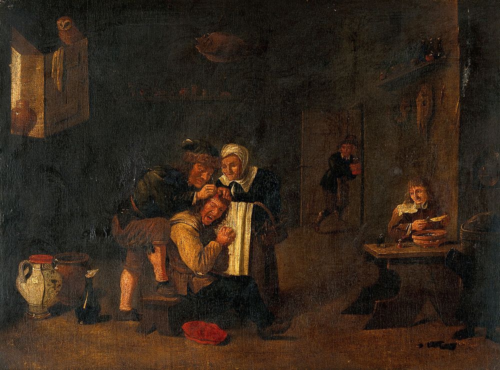 A surgical operation on a man's head. Oil painting by a follower of David Teniers the younger.