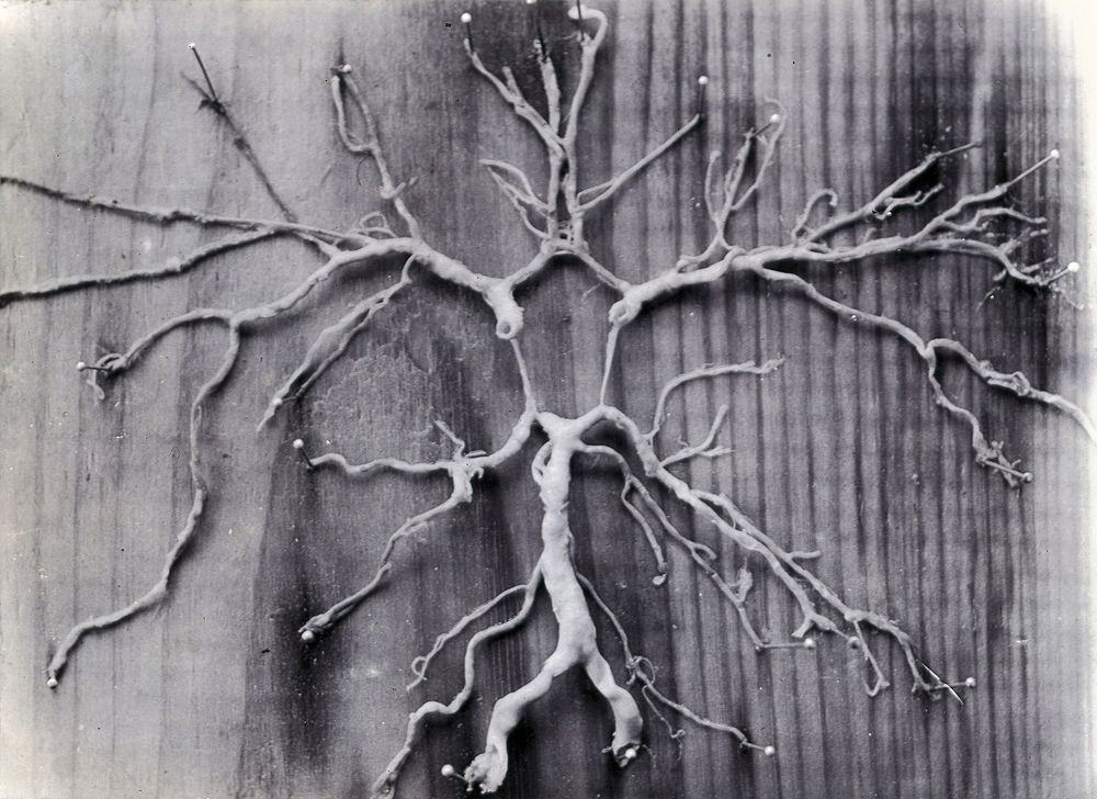 Friern Hospital, London: dissected arteries stretched out and pinned onto a wooden board. Photograph, 1890/1910.