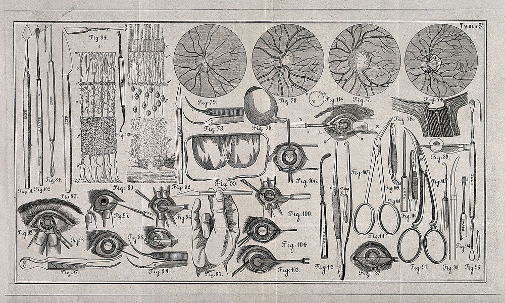A sheet showing optical instruments, eye examinations and anatomical diagrams of the eye with a numbered key. Wood engraving.