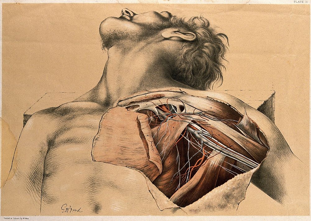 Dissection showing the axillary blood-vessels and the brachial plexus of nerves. Colour lithograph by G.H. Ford, 1867.