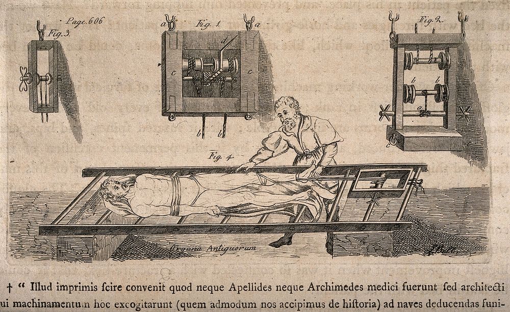 The use of the glossocoma to rejoin a dislocated joint. Etching by J. Bell after Oribasius.