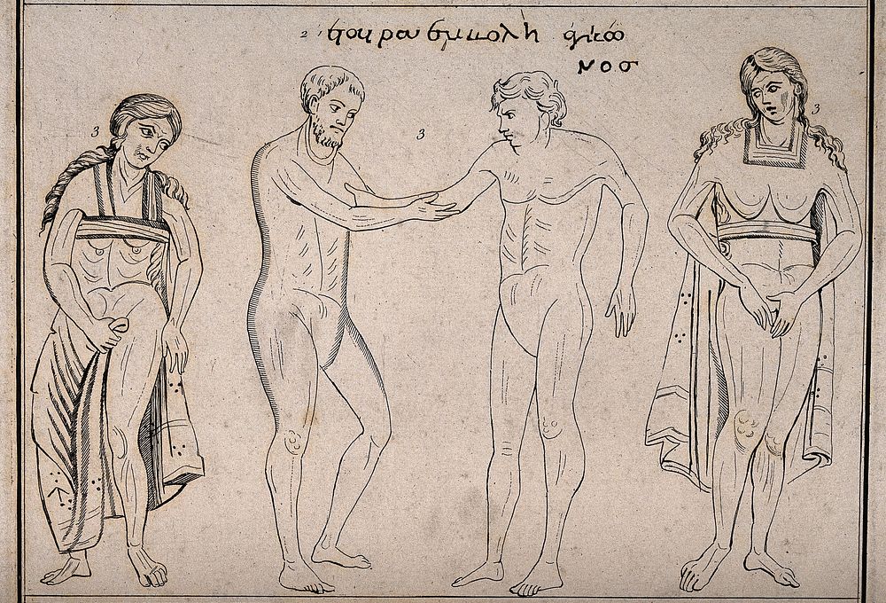 Top, three bandaged heads; centre, a naked surgeon sets the arm of a naked patient both flanked by bandaged women; bottom…
